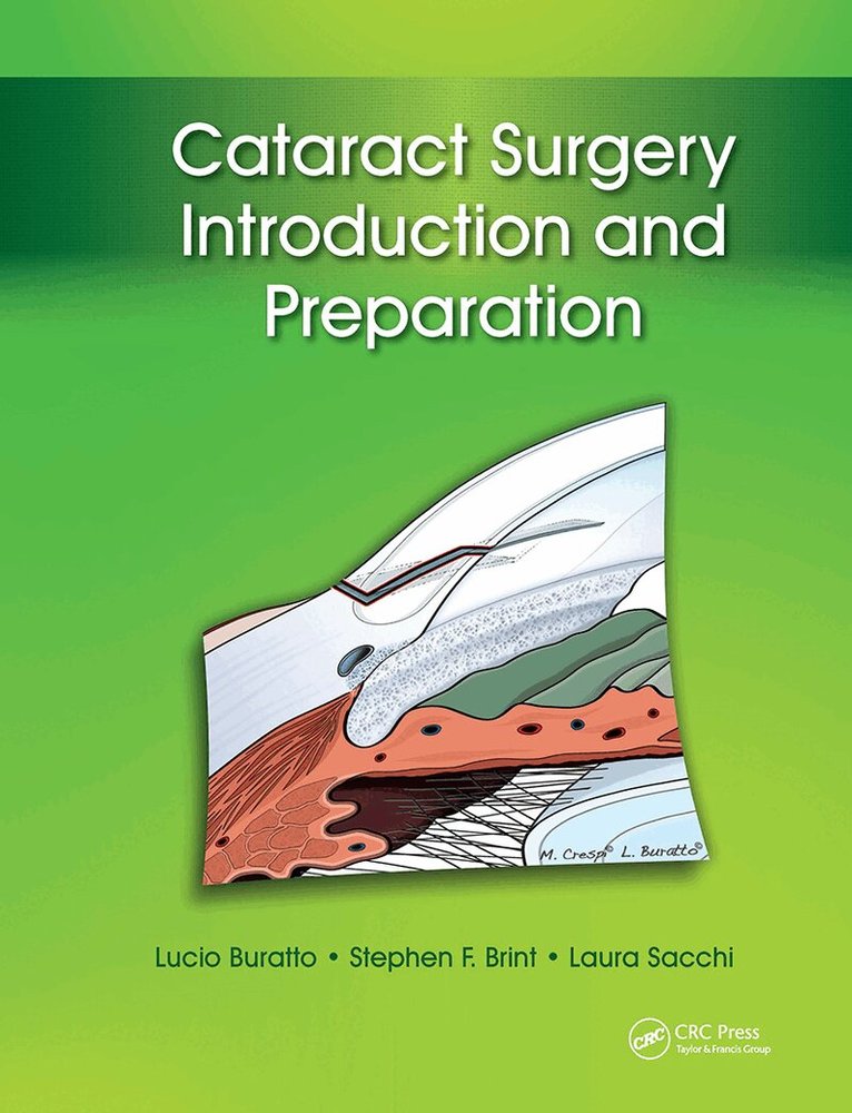 Lucio Buratto, Stephen Brint, Laura Sacchi - Cataract Surgery, Inbunden. Tillgänglighet: Lägg i varukorg