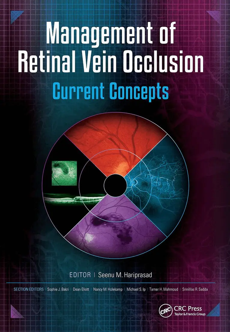 Seenu Hariprasad - Management of Retinal Vein Occlusion, Inbunden. Tillgänglighet: Lägg i varukorg