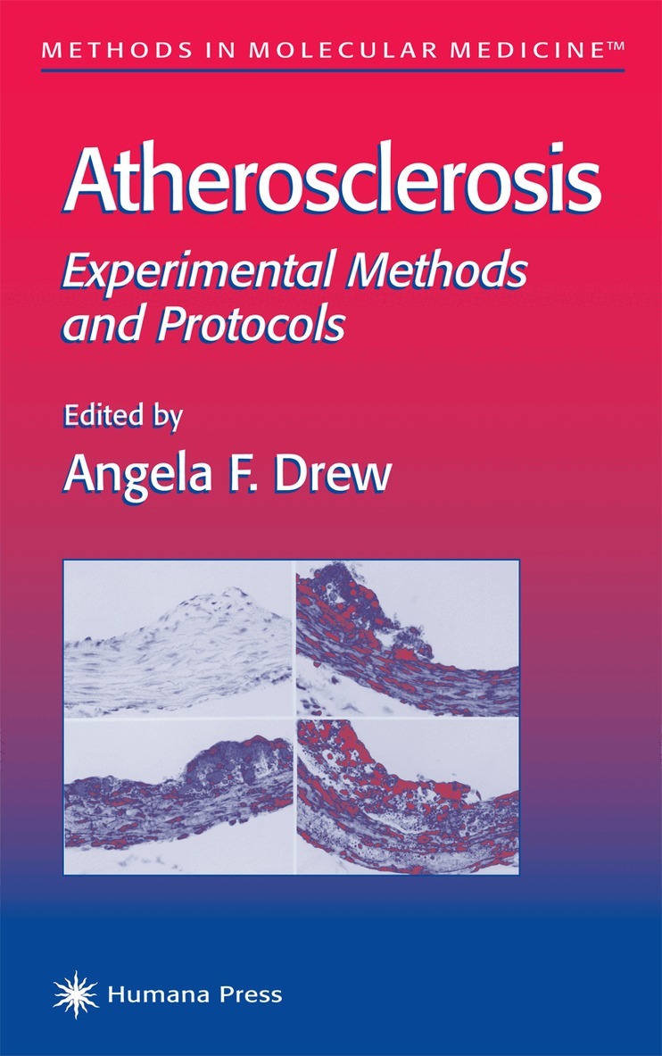 Angela F. Drew - Atherosclerosis, Häftad