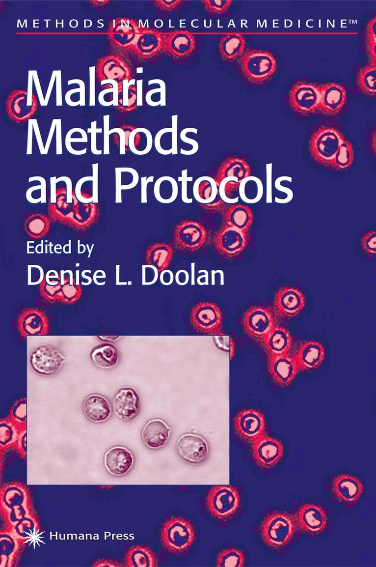 Denise L. Doolan - Malaria Methods and Protocols, Häftad. Tillgänglighet: Lägg i varukorg