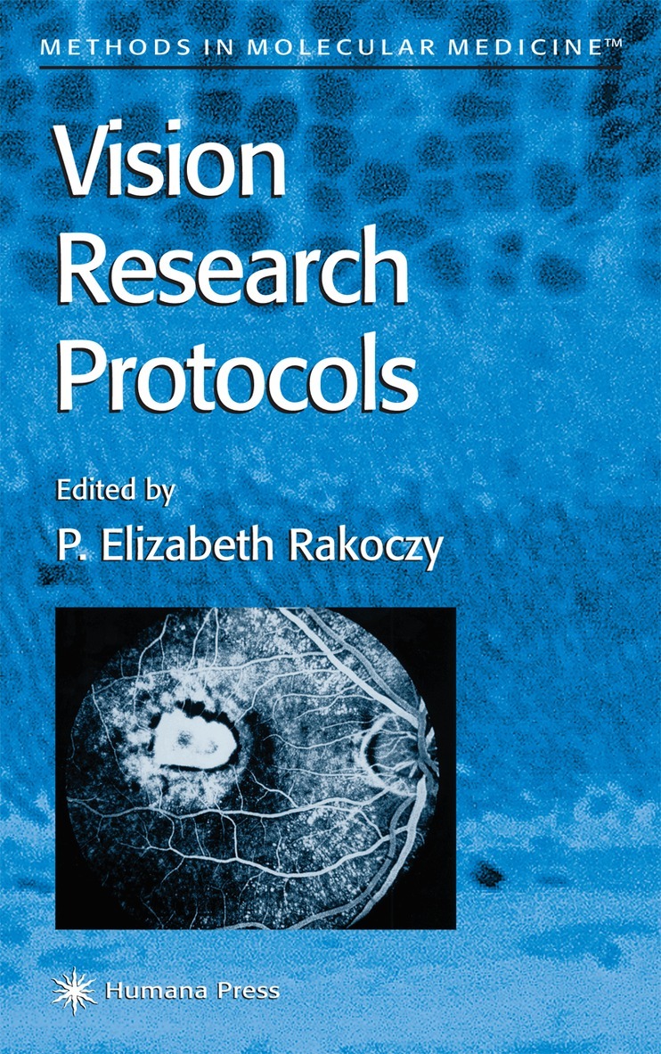 P. Elizabeth Rakoczy - Vision Research Protocols, Häftad. Tillgänglighet: Lägg i varukorg