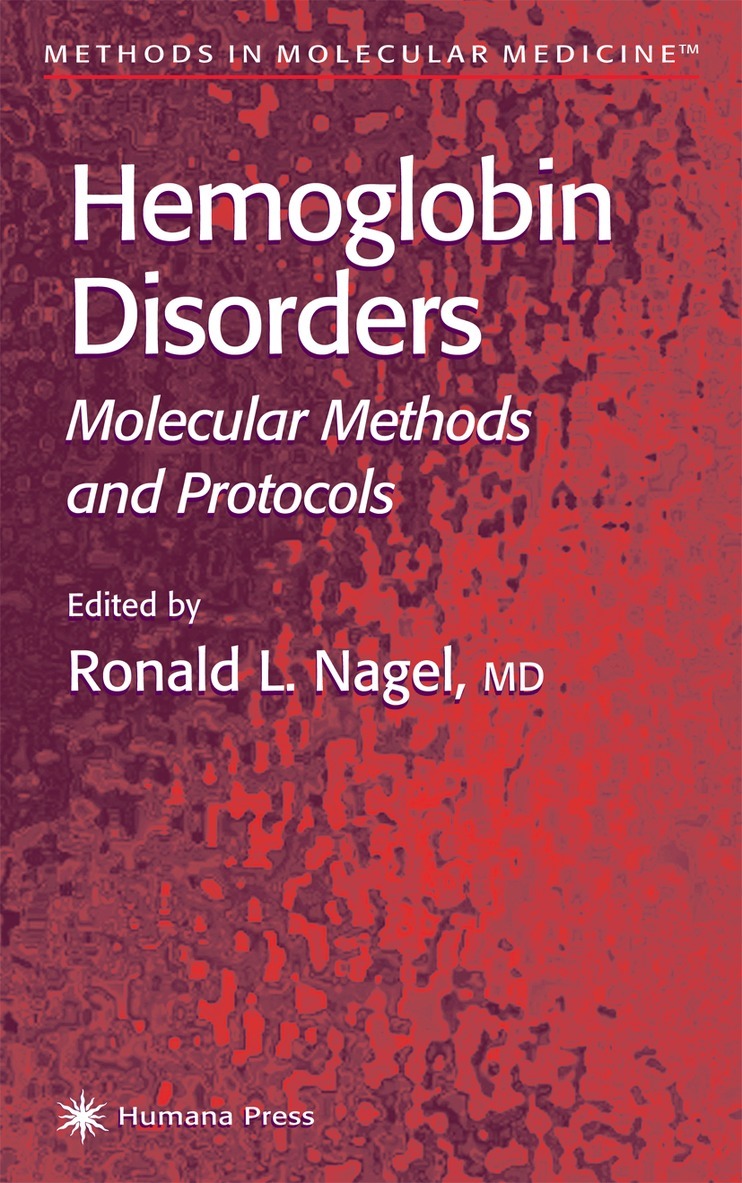 Ronald L. Nagel - Hemoglobin Disorders, Häftad. Tillgänglighet: Lägg i varukorg