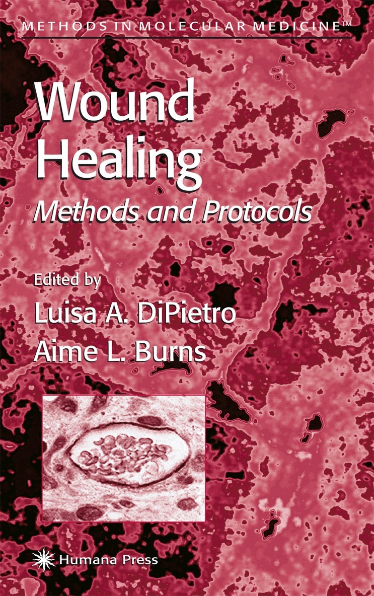 Luisa A. DiPietro, Aime L. Burns - Wound Healing, Häftad