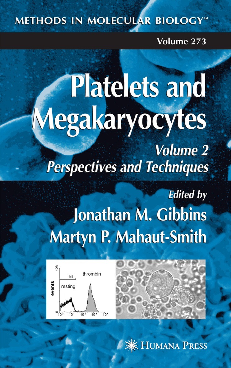Jonathan M. Gibbins, Martyn P. Mahaut-Smith - Platelets and Megakaryocytes, Häftad. Tillgänglighet: Lägg i varukorg