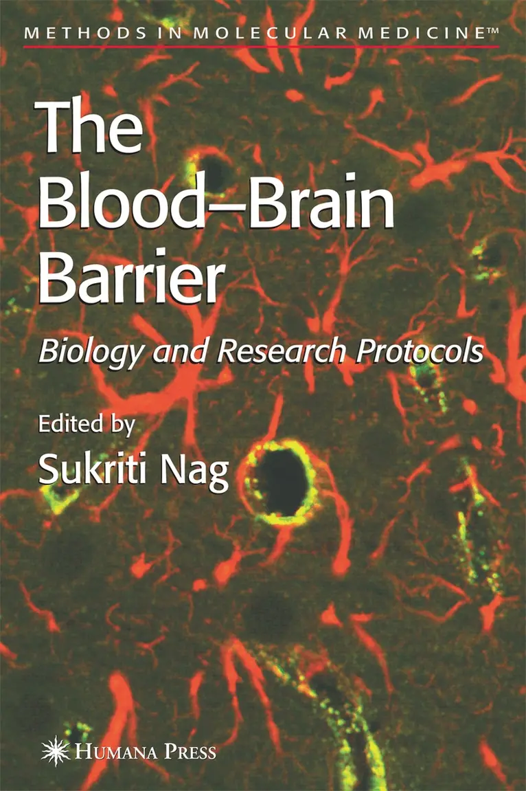 Sukriti Nag - Blood'Brain Barrier, Häftad. Tillgänglighet: Lägg i varukorg