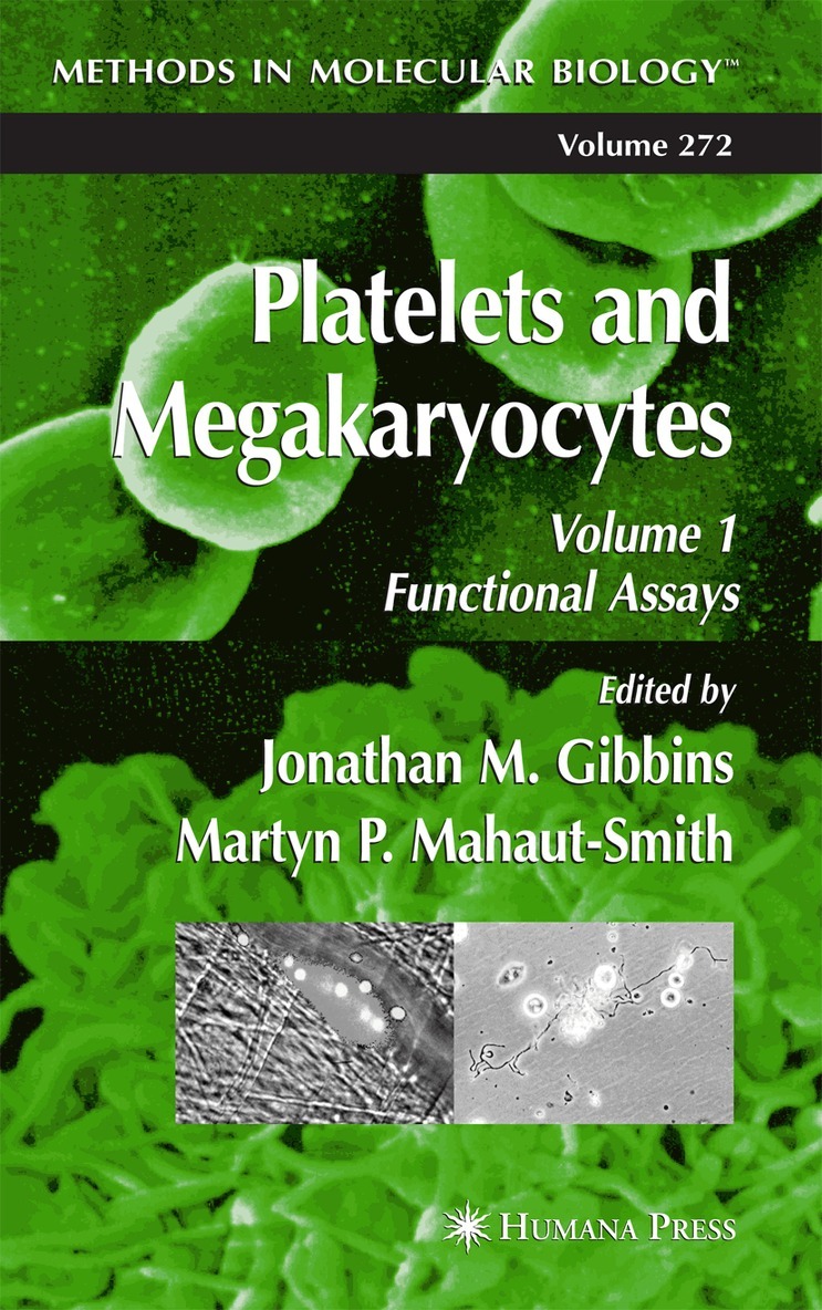 Jonathan M. Gibbins, Martyn P. Mahaut-Smith - Platelets and Megakaryocytes, Häftad. Tillgänglighet: Lägg i varukorg