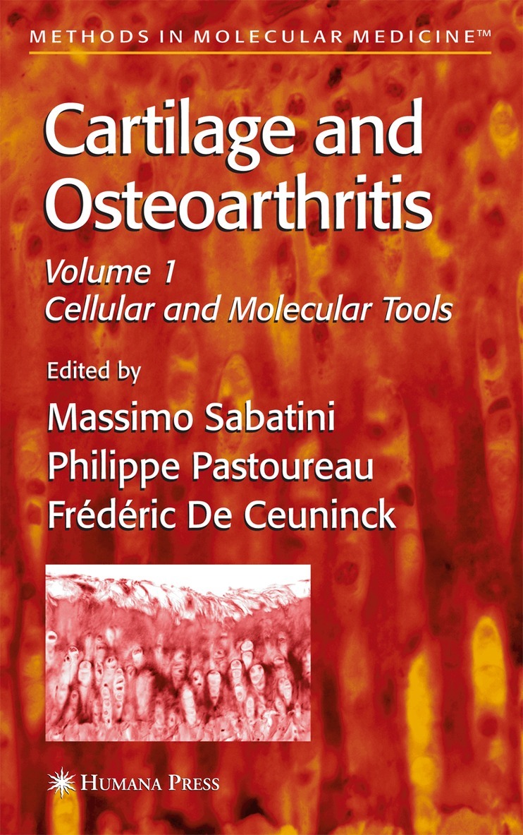 Massimo Sabatini, Philippe Pastoureau, FrTdTric De Ceuninck - Cartilage and Osteoarthritis, Häftad. Tillgänglighet: Lägg i varukorg