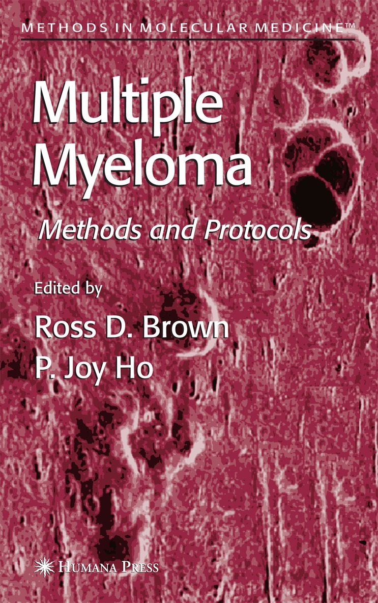 Ross D. Brown, P. Joy Ho - Multiple Myeloma, Häftad. Tillgänglighet: Lägg i varukorg