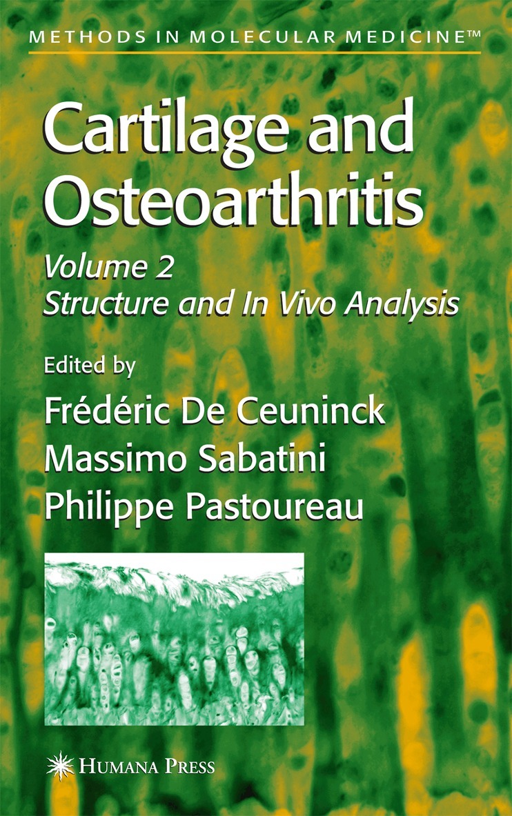 Massimo Sabatini, Philippe Pastoureau, FrTdTric De Ceuninck - Cartilage and Osteoarthritis, Häftad. Tillgänglighet: Lägg i varukorg