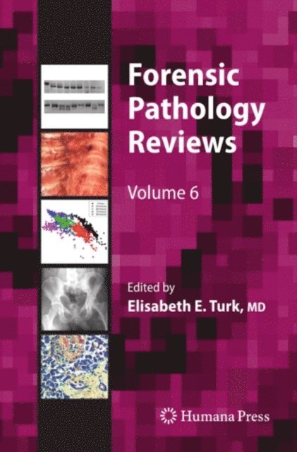 Elisabeth E. Turk - Forensic Pathology Reviews, E-bok