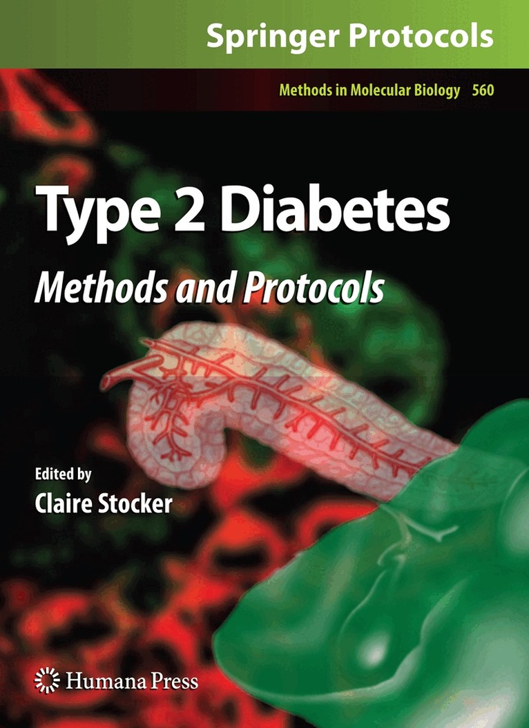 Claire Stocker, Claire Stocker - Type 2 Diabetes, Häftad