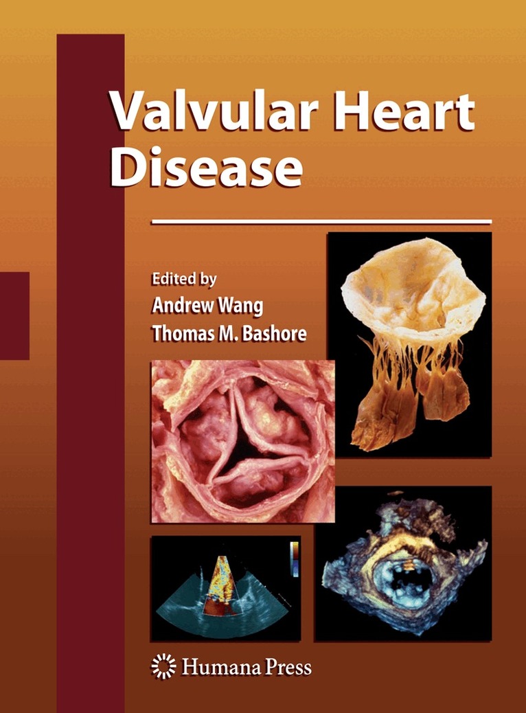 Andrew Wang, Thomas M. Bashore - Valvular Heart Disease, Häftad
