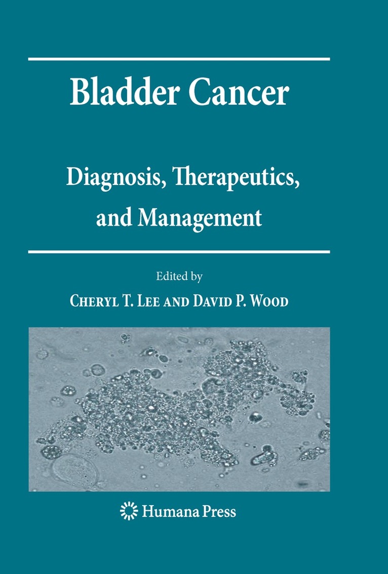 Cheryl T. Lee, David P. Wood - Bladder Cancer, Häftad