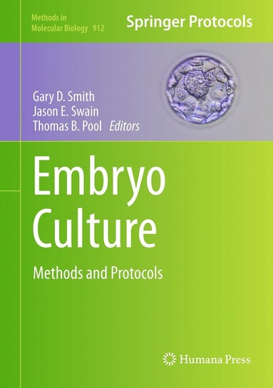 Embryo Culture av Gary D Smith, Jason E Swain, Thomas B Pool