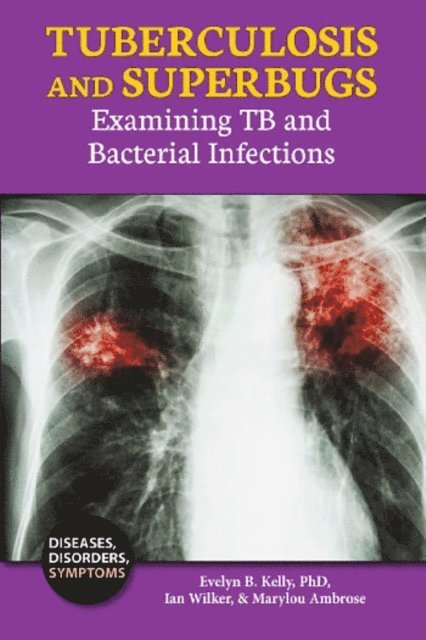 Marylou Ambrose, Ian Wilker - Tuberculosis and Superbugs, E-bok
