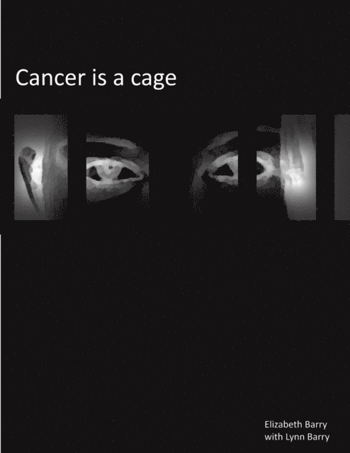 Lynn Barry, Elizabeth Barry - Cancer Is A Cage, E-bok