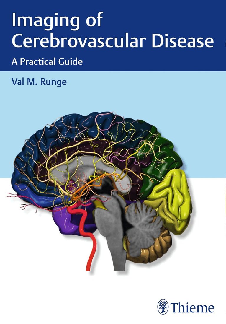 Val M. Runge - Imaging of Cerebrovascular Disease, Häftad