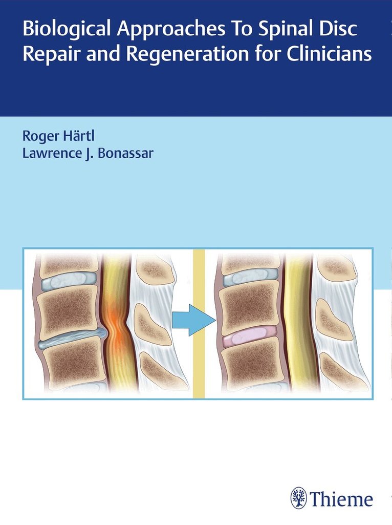 Roger Hartl, Larry Bonassar - Biological Approaches to Spinal Disc Repair and Regeneration for Clinicians, Inbunden