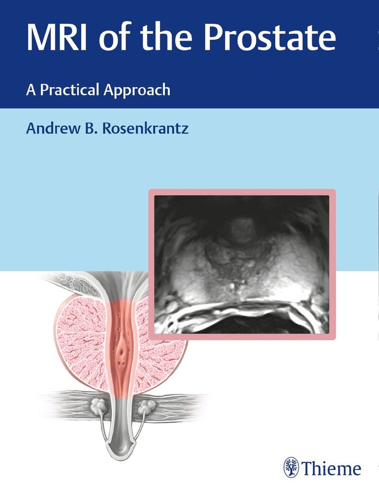 Andrew Rosenkrantz - MRI of the Prostate, Inbunden. Tillgänglighet: Lägg i varukorg
