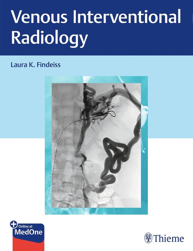 Laura K. Findeiss - Venous Interventional Radiology. Tillgänglighet: Lägg i varukorg