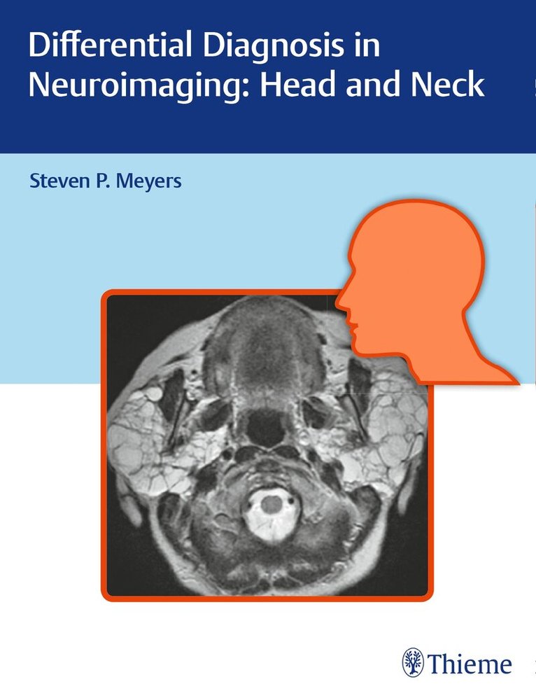 Steven Meyers - Differential Diagnosis in Neuroimaging: Head and Neck, Inbunden