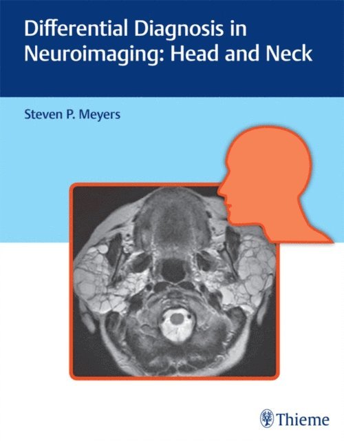 Steven P. Meyers - Differential Diagnosis in Neuroimaging: Head and Neck, E-bok. Tillgänglighet: Lägg i varukorg