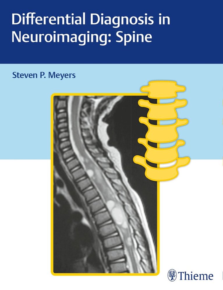 Steven Meyers - Differential Diagnosis in Neuroimaging: Spine, Inbunden