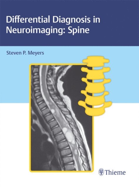 Steven P. Meyers - Differential Diagnosis in Neuroimaging: Spine, E-bok. Tillgänglighet: Lägg i varukorg