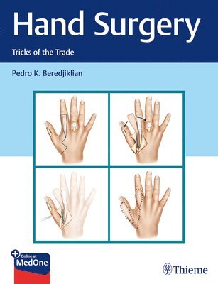 Hand Surgery av Pedro Beredjiklian
