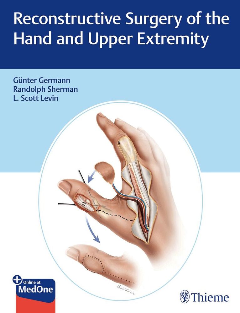 Günter Germann, L. Scott Levin, Randolph Sherman - Reconstructive Surgery of the Hand and Upper Extremity, Övrigt