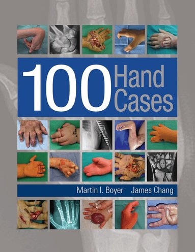 100 Hand Cases by Martin Boyer, James Chang