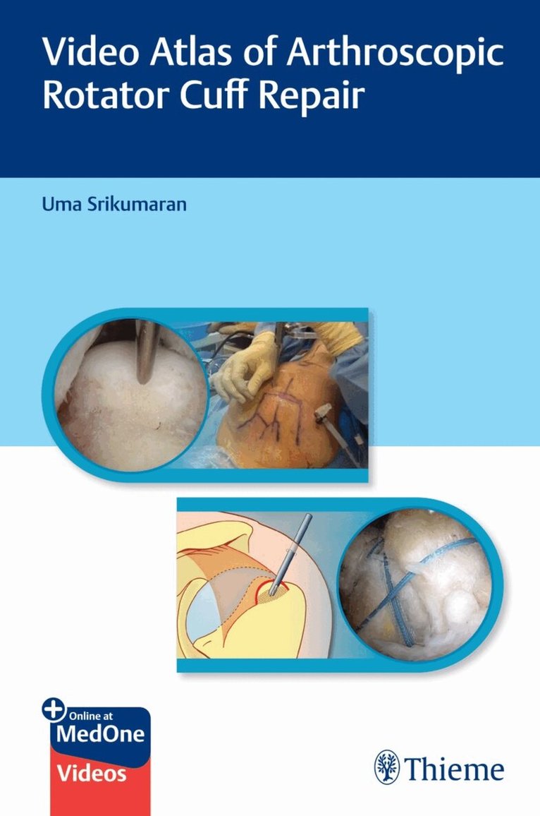 Uma Srikumaran - Video Atlas of Arthroscopic Rotator Cuff Repair, Övrigt