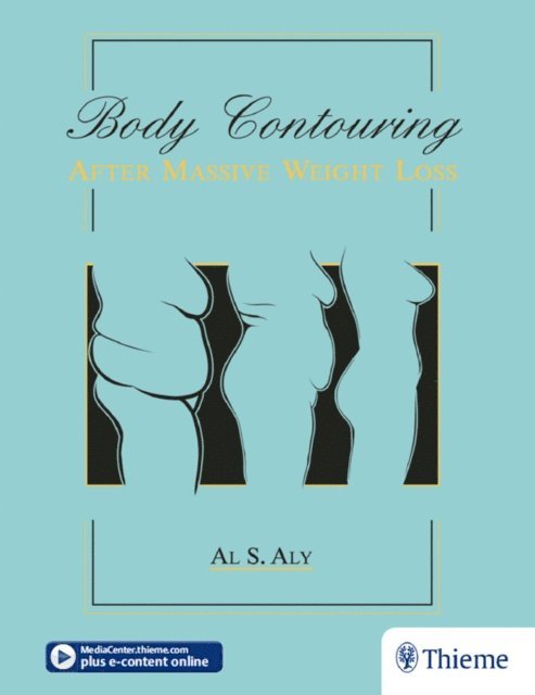 Al S. Aly - Body Contouring after Massive Weight Loss, E-bok