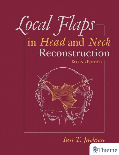 Ian T. Jackson - Local Flaps in Head and Neck Reconstruction, E-bok