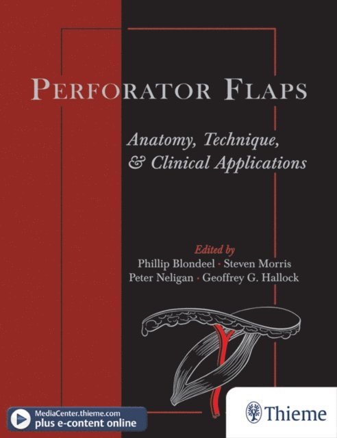 Peter Neligan, Steven Morris, Phillip Blondeel - Perforator Flaps, E-bok