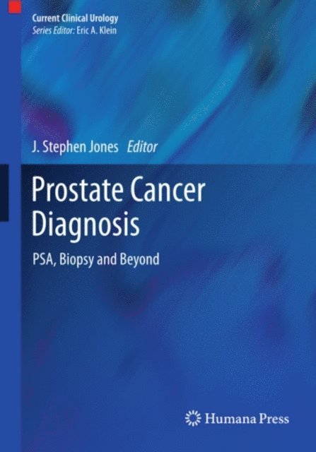 J. Stephen Jones - Prostate Cancer Diagnosis, E-bok