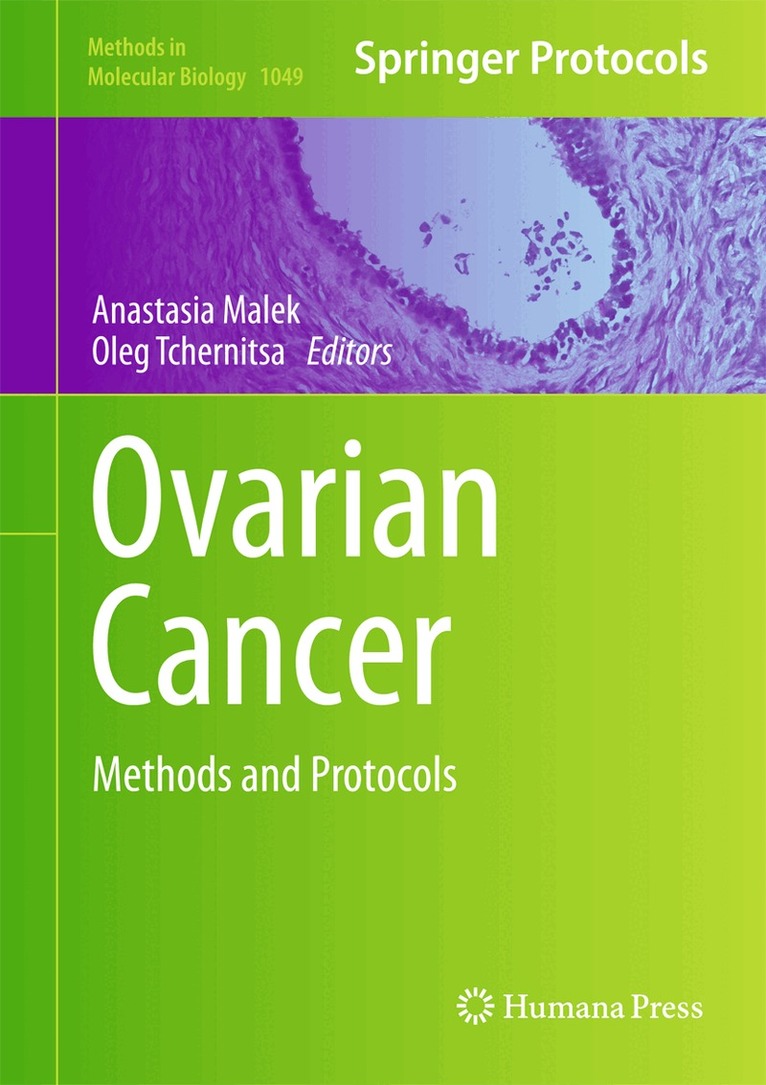 Anastasia Malek, Oleg Tchernitsa - Ovarian Cancer, Inbunden