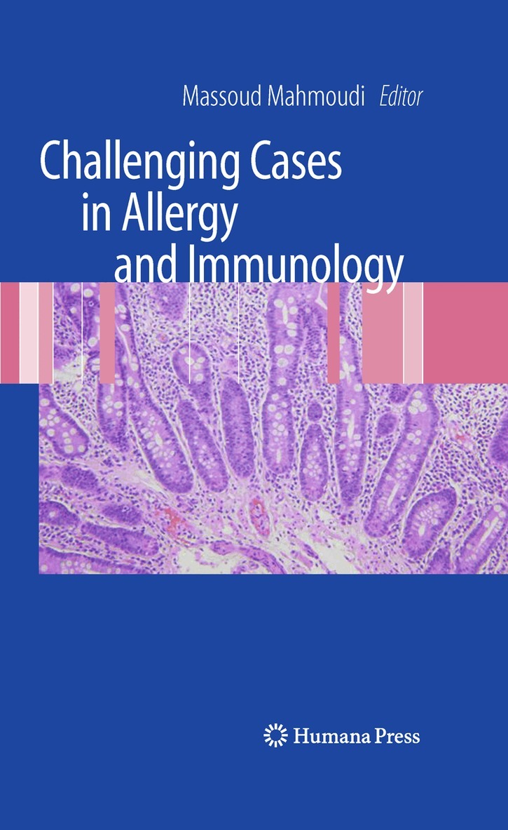 Massoud Mahmoudi - Challenging Cases in Allergy and Immunology, Häftad. Tillgänglighet: Lägg i varukorg