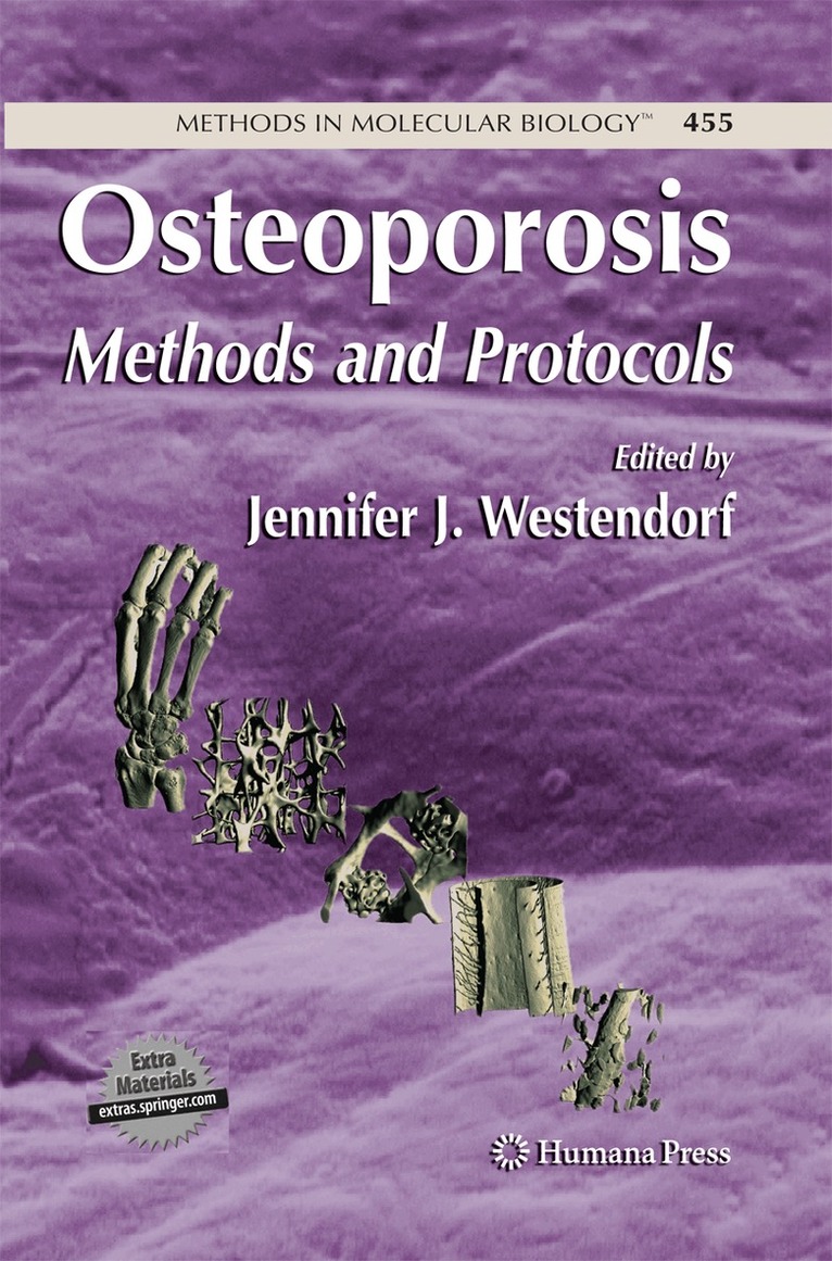Jennifer Westendorf - Osteoporosis, Häftad