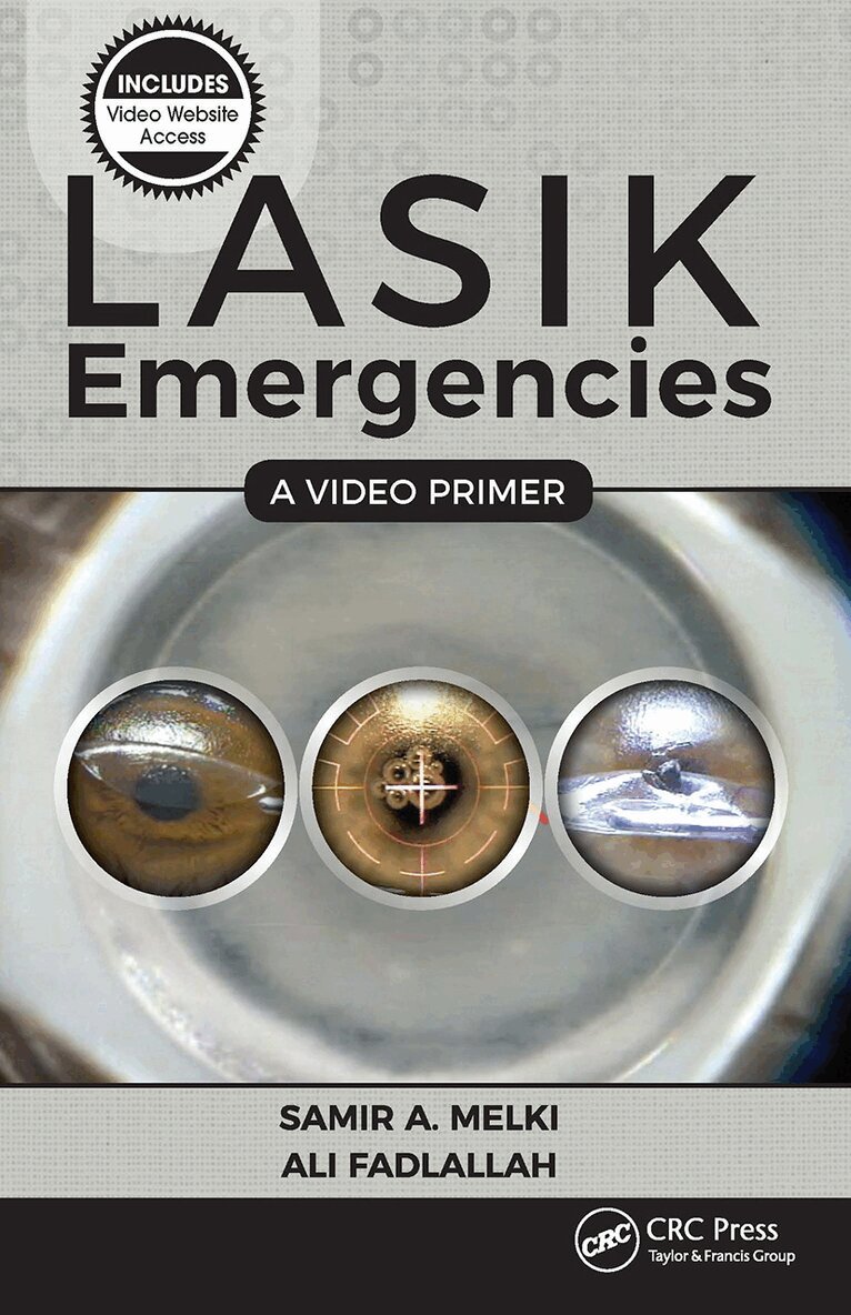 Samir A. Melki, Ali Fadlallah - LASIK Emergencies: A Video Primer, Häftad. Tillgänglighet: Lägg i varukorg