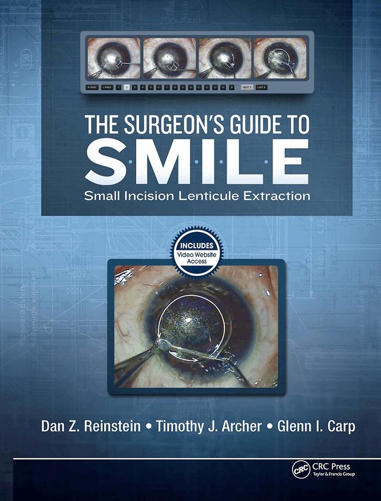 Dan Reinstein, Timothy Archer, Glenn Carp - Surgeon’s Guide to SMILE, Inbunden. Tillgänglighet: Lägg i varukorg