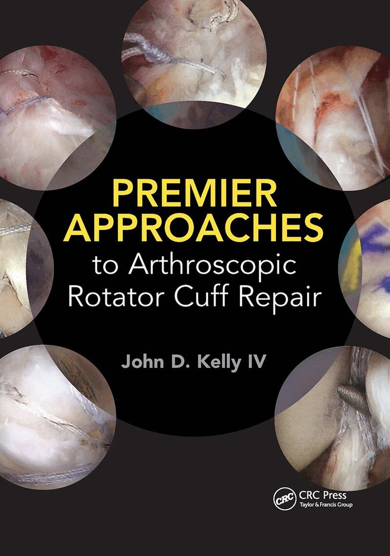John Kelly - Premier Approaches to Arthroscopic Rotator Cuff Repair, Häftad