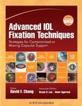 Advanced IOL Fixation Techniques