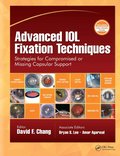 Advanced IOL Fixation Techniques