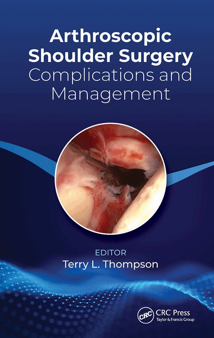 Terry Thompson - Arthroscopic Shoulder Surgery, Häftad. Tillgänglighet: Lägg i varukorg