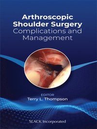 Arthroscopic Shoulder Surgery