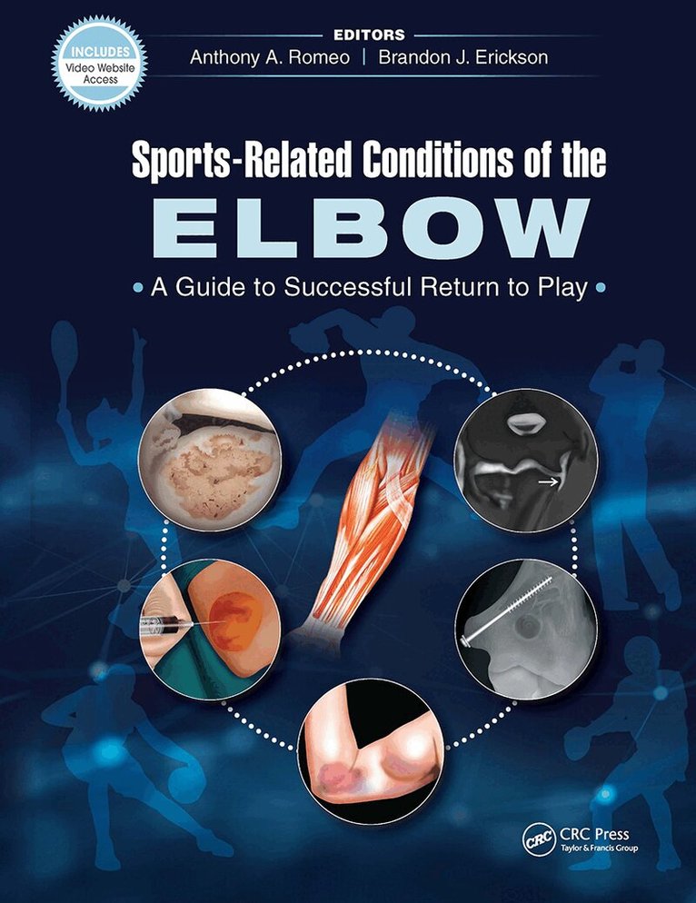 Anthony Romeo, Brandon Erickson - Sports-Related Conditions of the Elbow, Inbunden