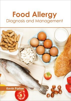 Kevin Parker - Food Allergy: Diagnosis and Management, Inbunden