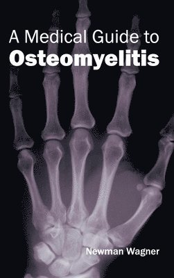 Newman Wagner - Medical Guide to Osteomyelitis, Inbunden. Tillgänglighet: Lägg i varukorg