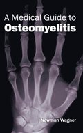 Medical Guide to Osteomyelitis